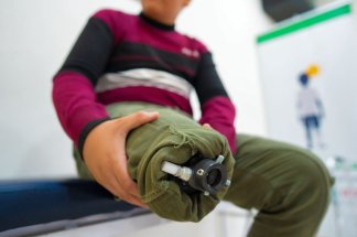 Dans un hôpital de Jordanie, paroles d'adolescents gazaouis, victimes d’Israël, amputés